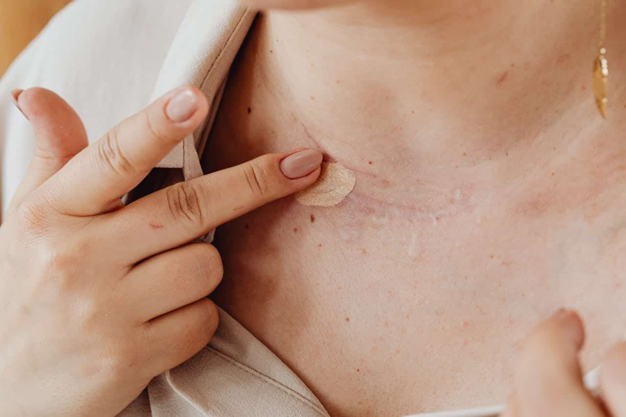 Woman applying a bandage on her neck skin